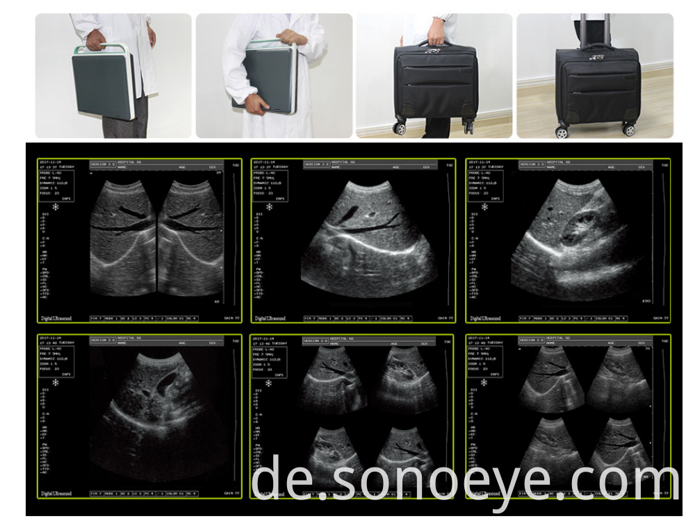 3D Laptop Ultrasound Machine for women with baby